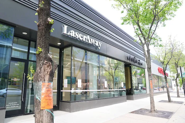 LaserAway River North Picture 1