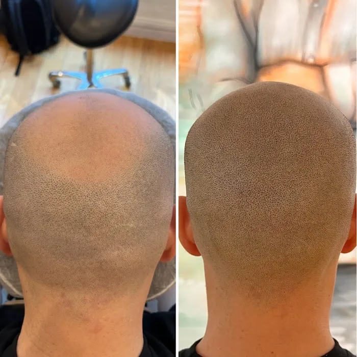 Scalp Micro USA - Chicago, IL Picture 7