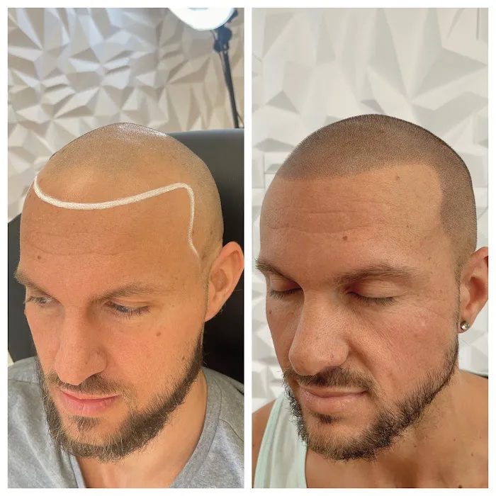 Scalp Micro USA - Chicago, IL Picture 3