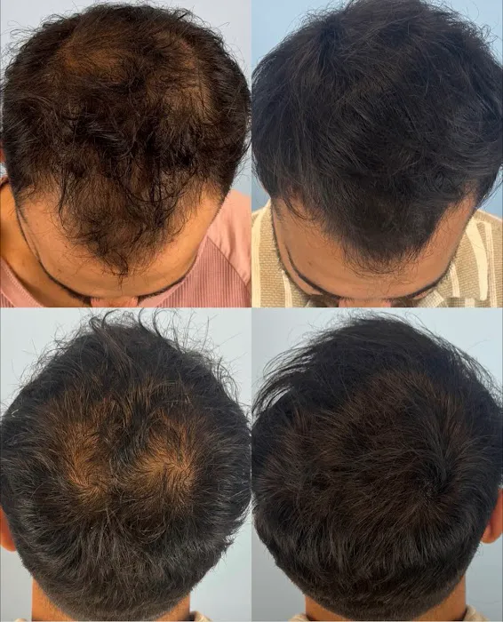 Chicago Hair Ink Picture 2