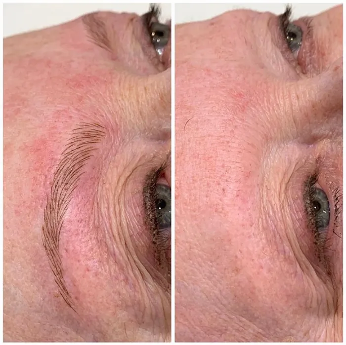 Strip custom waxing & skincare Picture 8