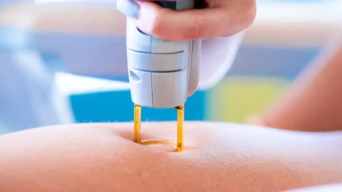 V&P Laser Hair Removal & Skin Care Picture 8