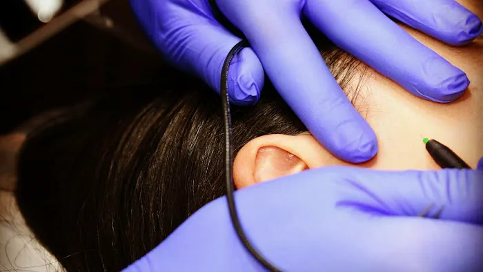 Electrolysis 100% Permanent Hair Removal & Skin Care Picture 10