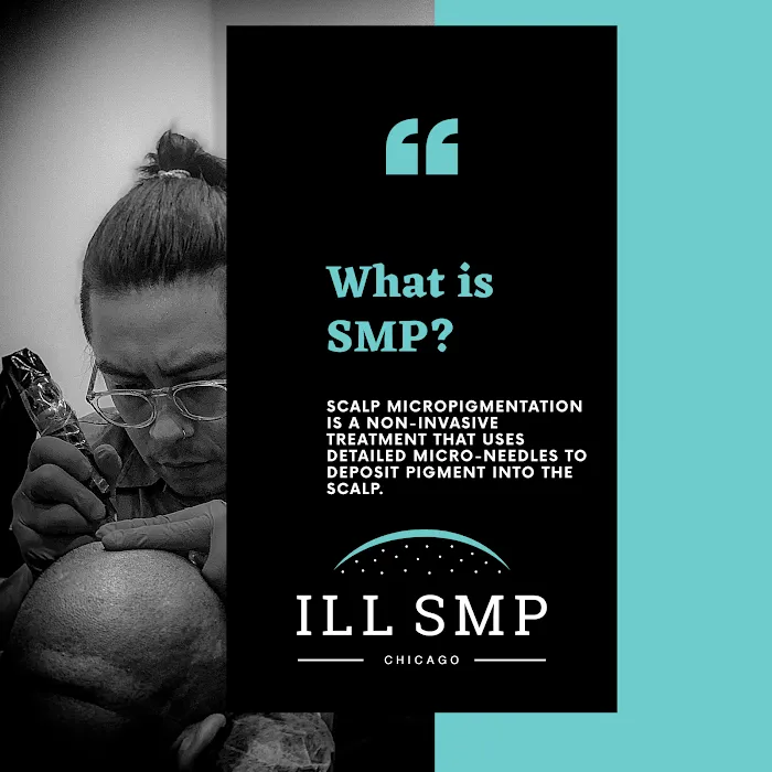 ILL SMP Picture 1