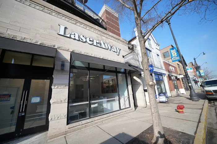 LaserAway Lincoln Park Picture 7