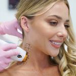 LaserAway Lincoln Park