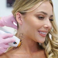 LaserAway Lincoln Park ico