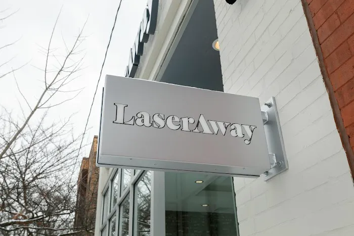 LaserAway - Bucktown Picture 5