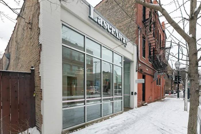 LaserAway - Bucktown Picture 7