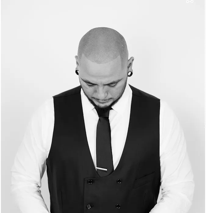 Fred312 scalp micropigmentation Picture 6
