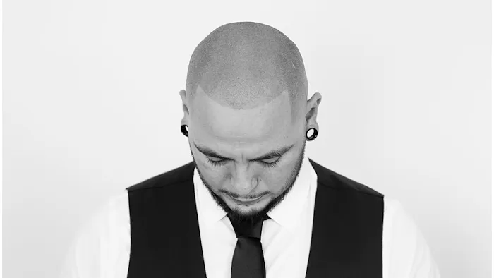 Fred312 scalp micropigmentation Picture 3