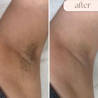 DL Esthetics ico