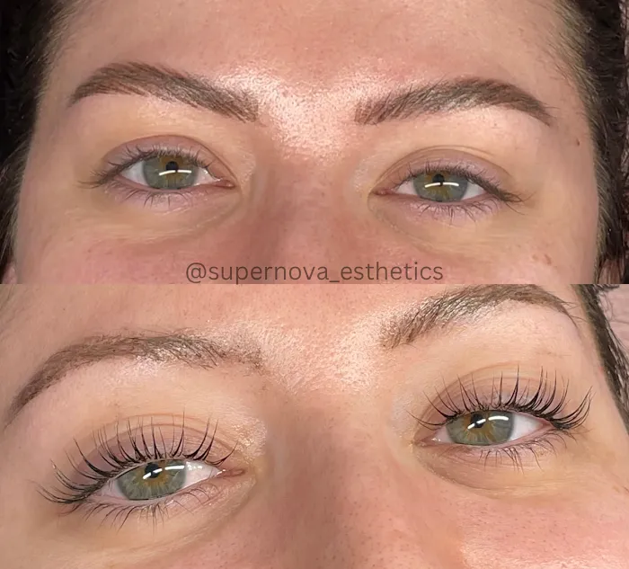 Supernova Esthetics | Sugaring Studio Picture 2
