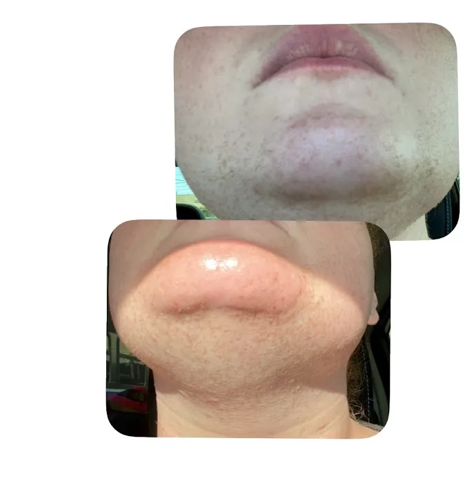 M Electrolysis Clinic Picture 5