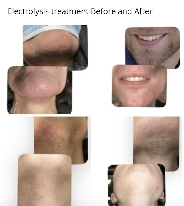 M Electrolysis Clinic Picture 4