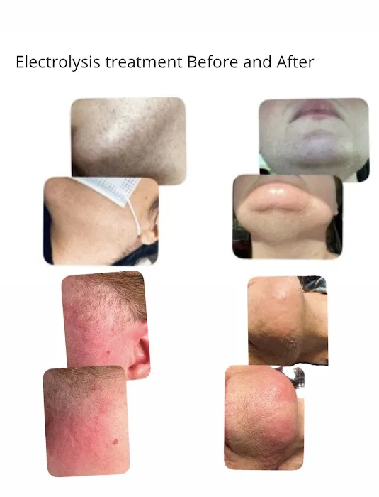 M Electrolysis Clinic Picture 2