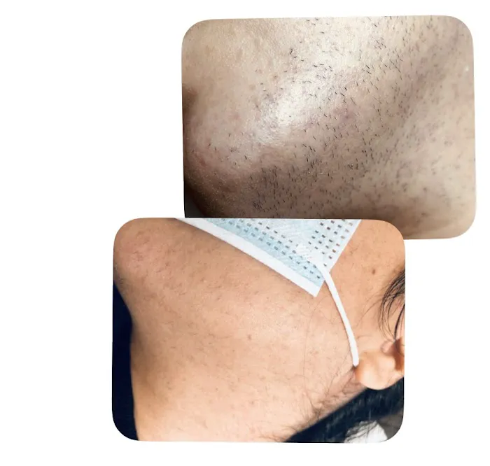 M Electrolysis Clinic Picture 10