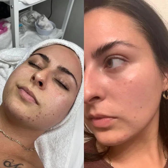 SkinByATIK Picture 3