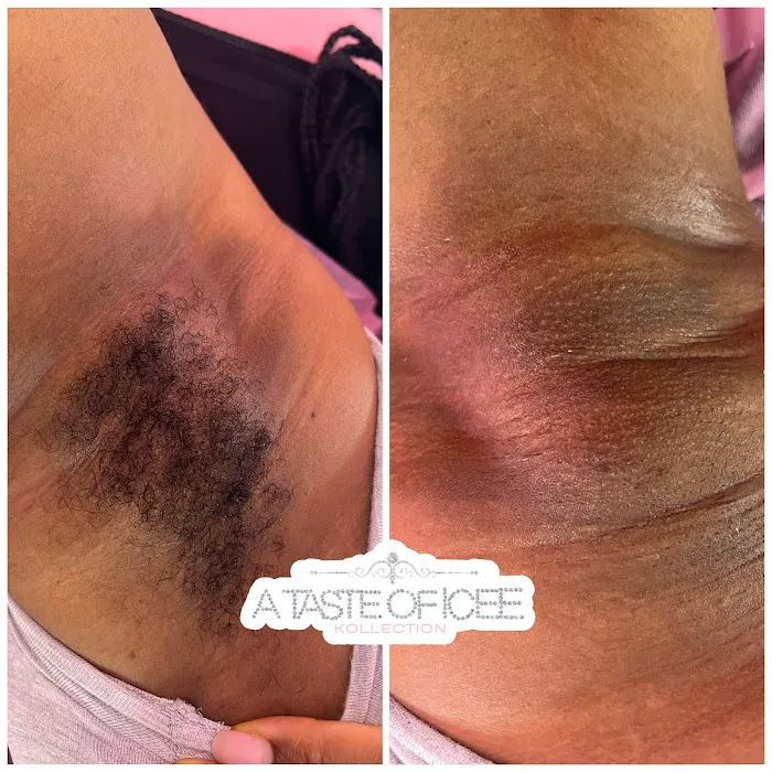 SkinByATIK Picture 2
