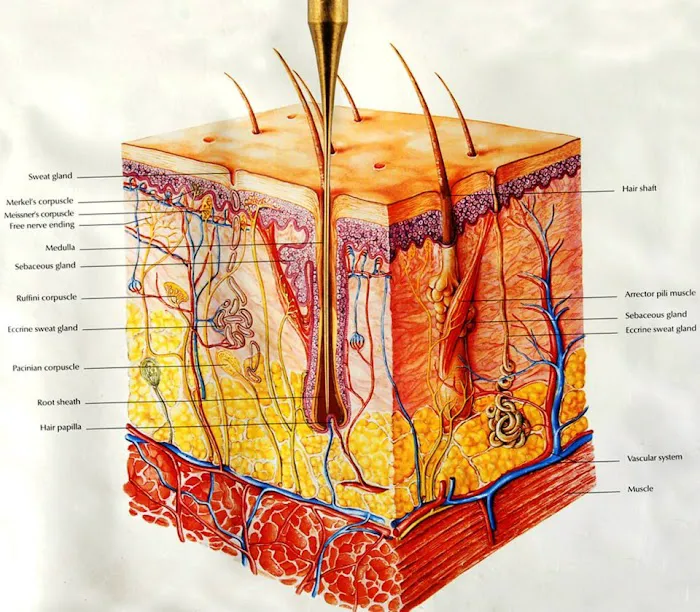 Electrolysis By Elena Picture 3