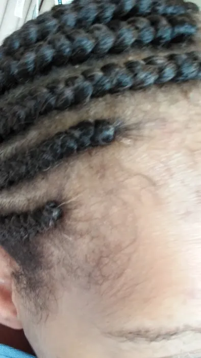 Mama Hair Braids Picture 1