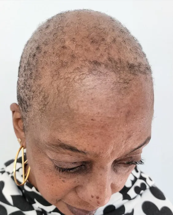 Picasso Scalp Micropigmentation- Chicago Picture 6