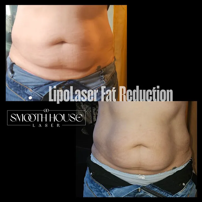 Smooth House Laser Spa Picture 10
