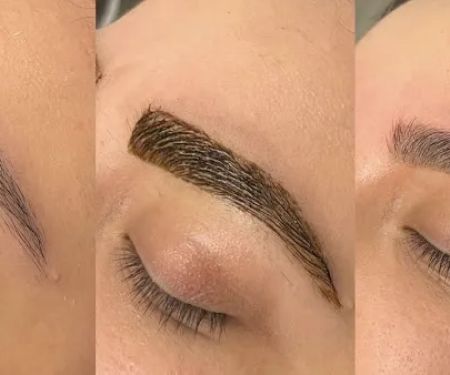 Gingerella’s Esthetics