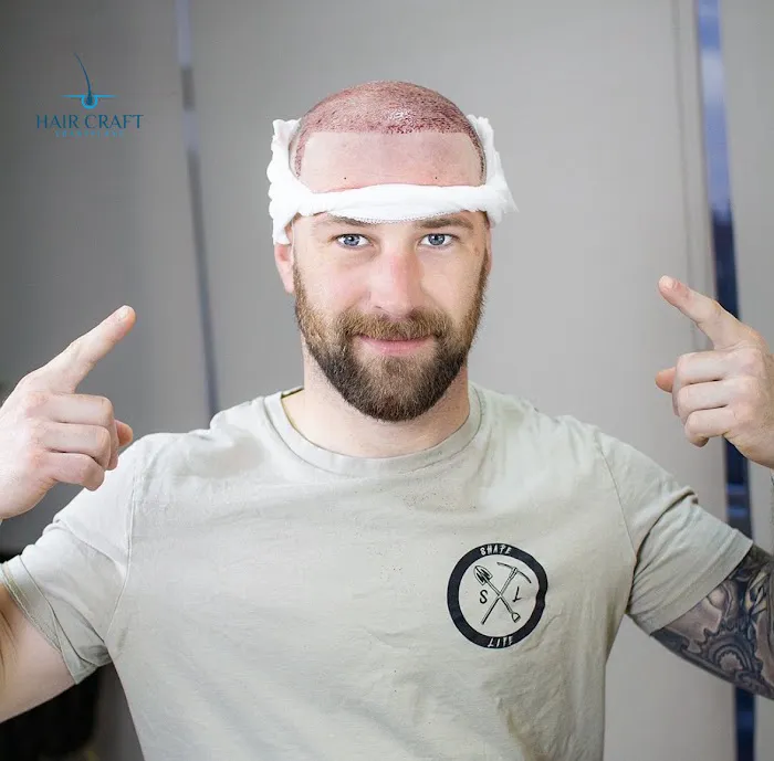 HairCraft Transplant Picture 3