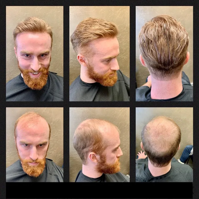 Hairline Creations, Inc. Picture 9