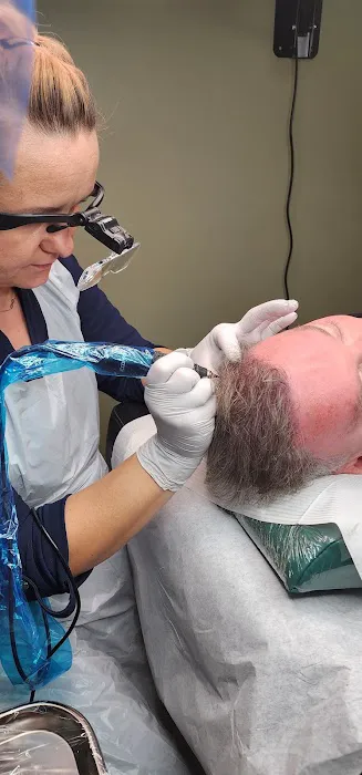 OM SCALP Micropigmentation Hair Tattoo Picture 2