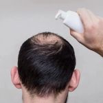 How to Prevent Hair Thinning in Men Naturally