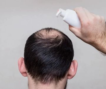 How to Prevent Hair Thinning in Men Naturally